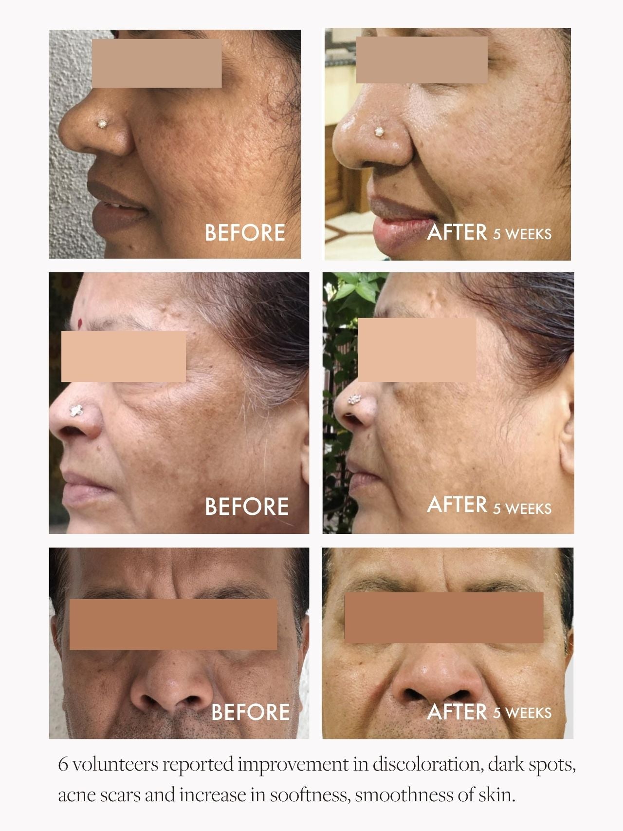 Wild Rosehip Supercritical Face Oil