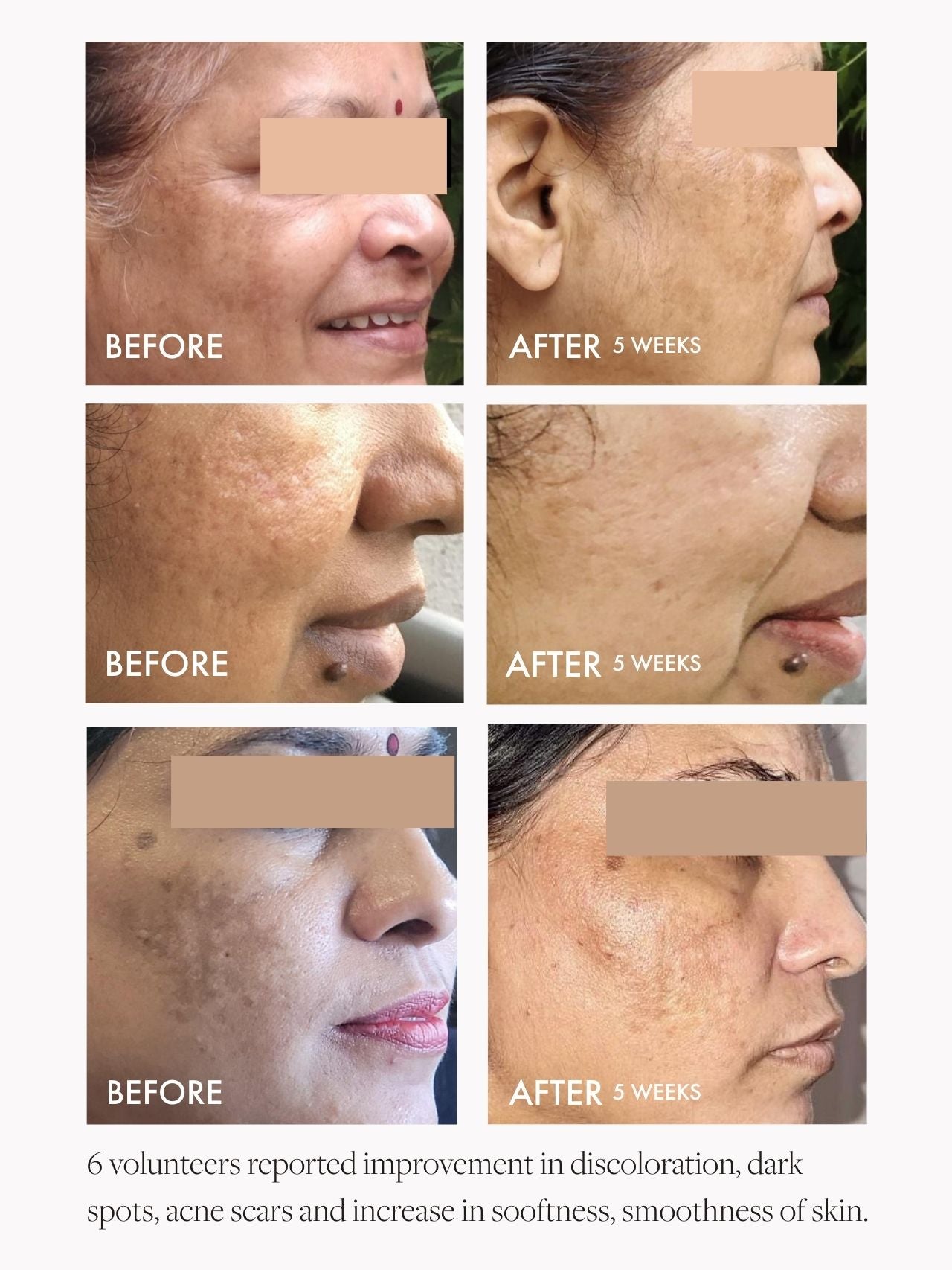 Wild Rosehip Supercritical Face Oil