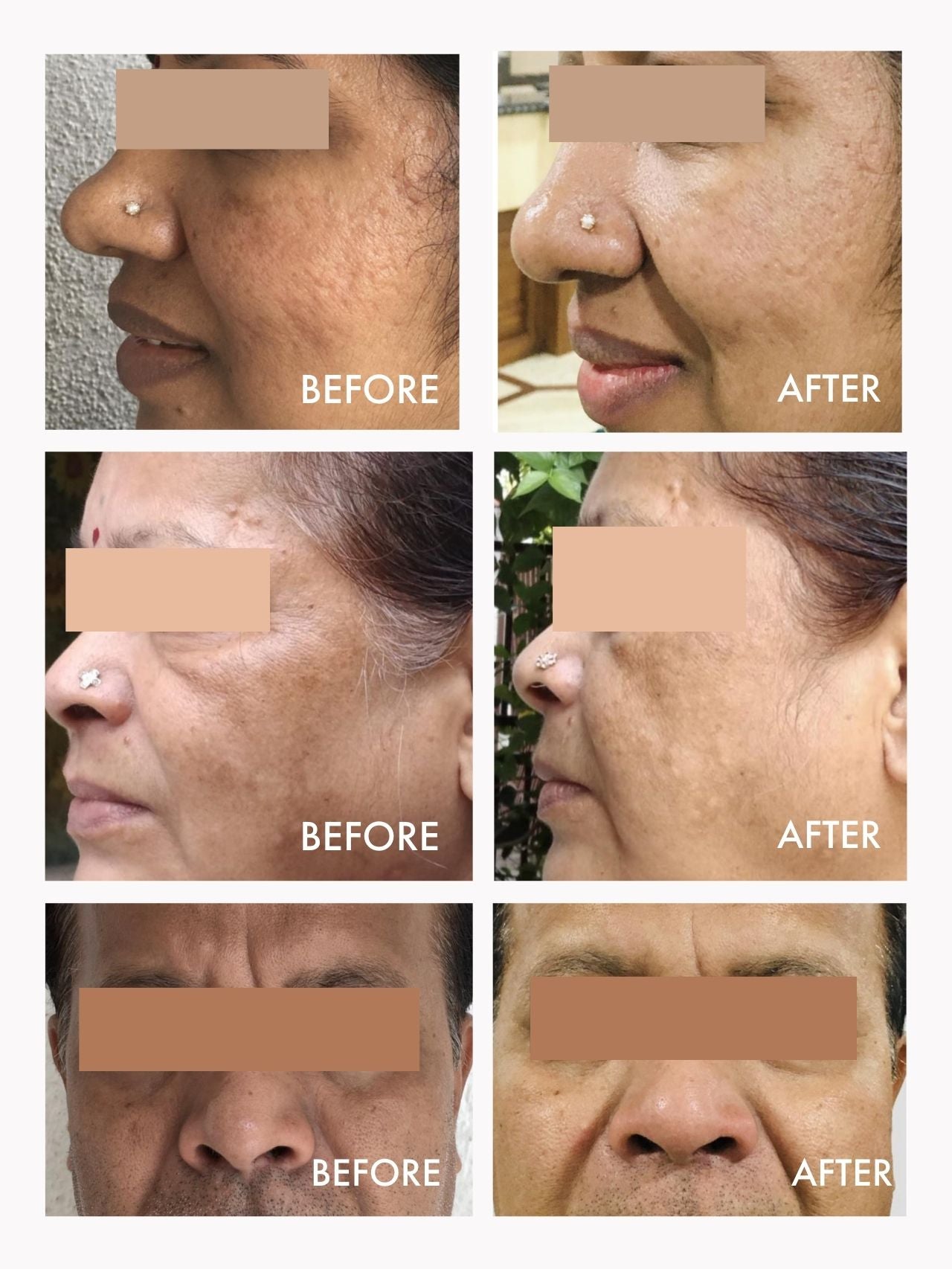 Wild Rosehip Supercritical Oil