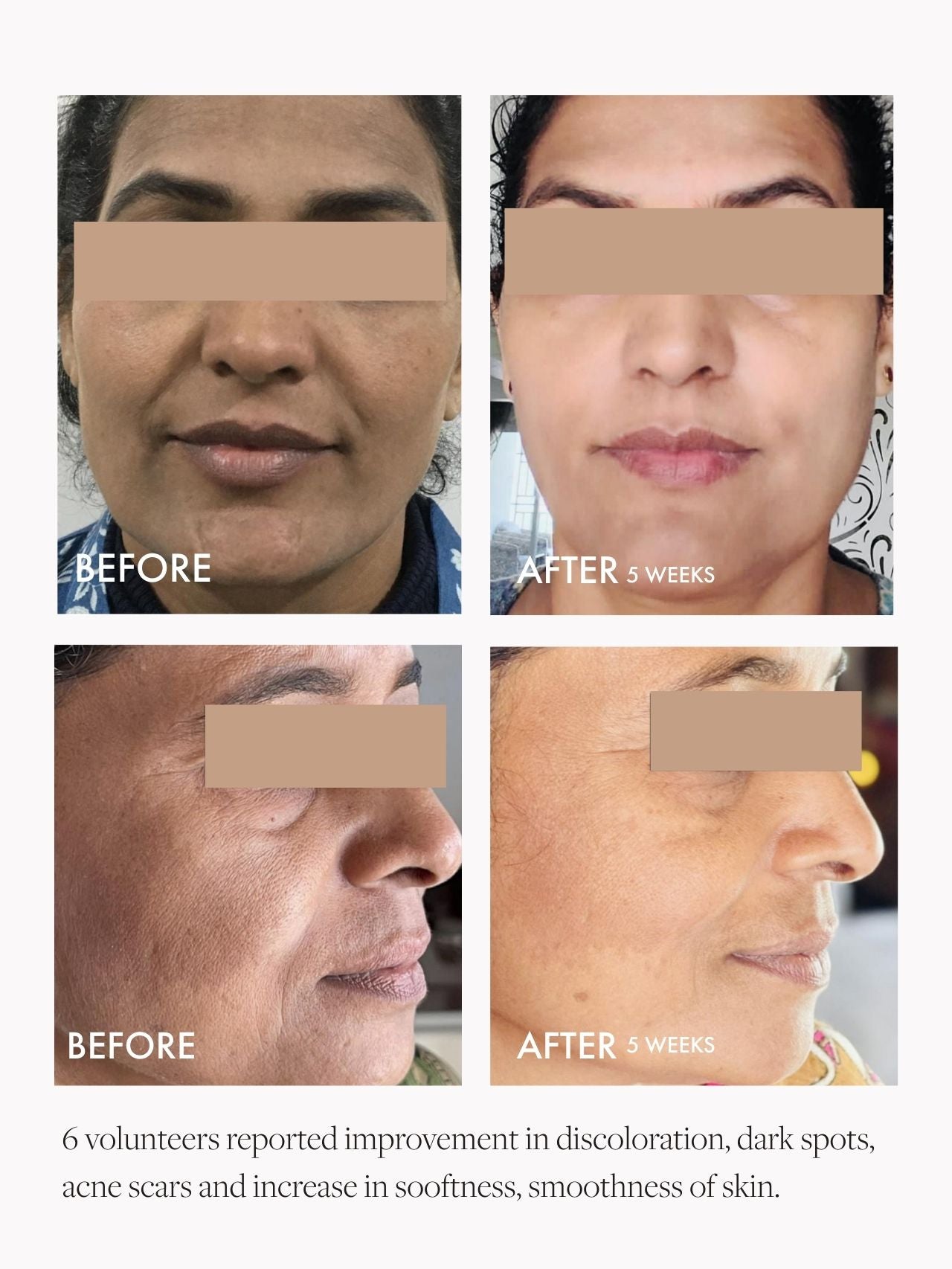 Wild Rosehip Supercritical Face Oil