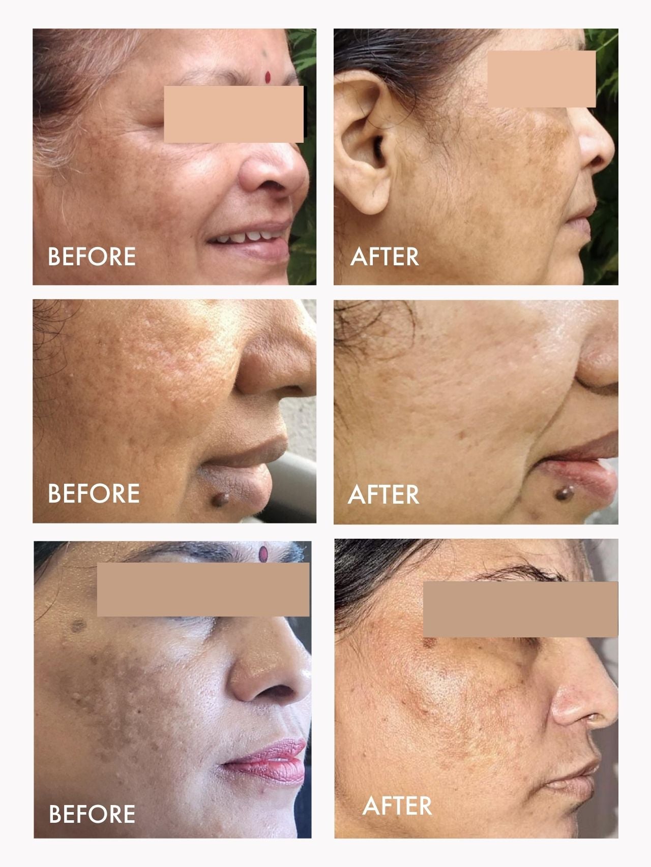 Wild Rosehip Supercritical Oil