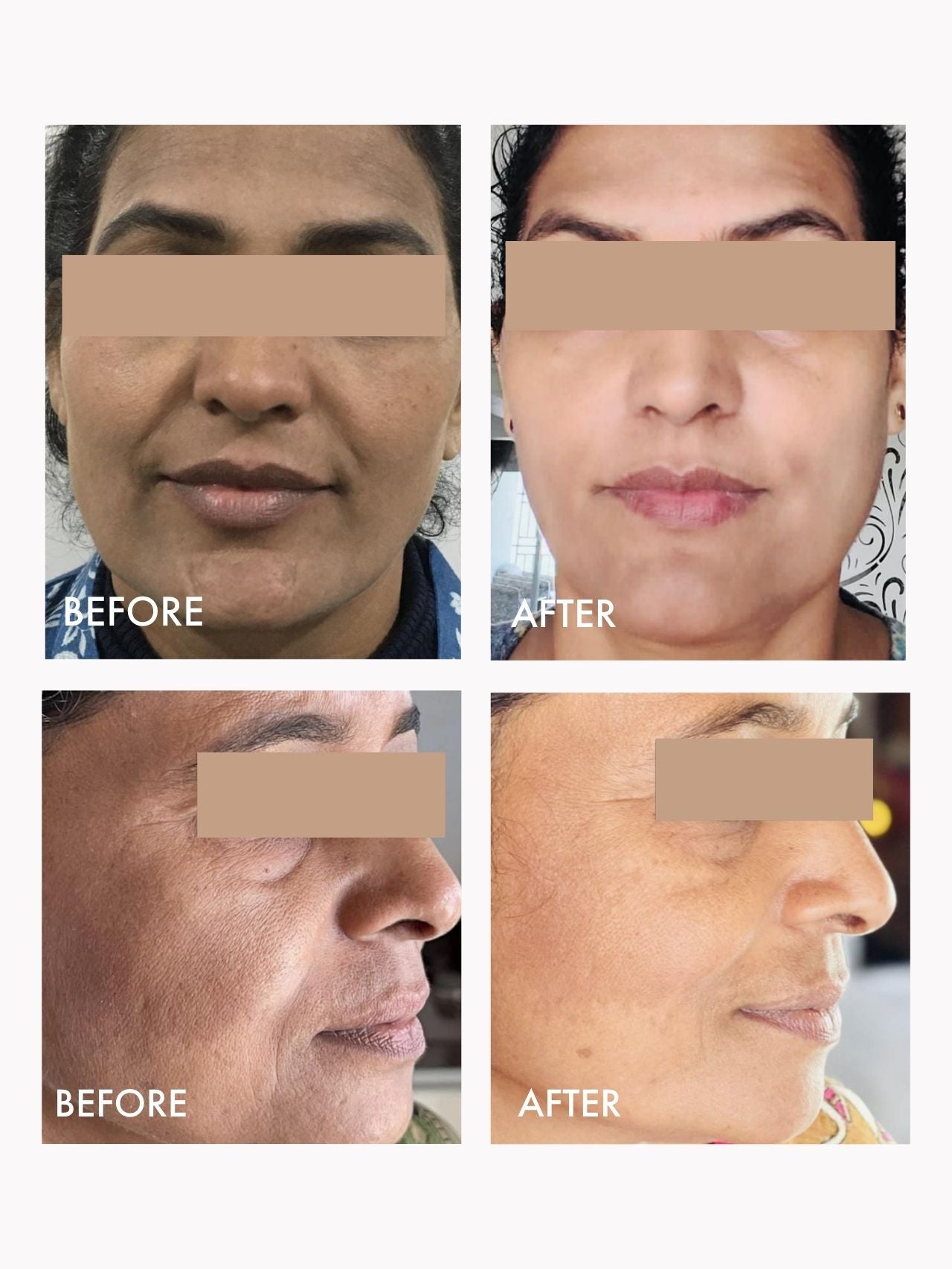 Wild Rosehip Supercritical Oil